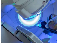 注入肿瘤的金纳米粒子可以改善癌症的放射治疗