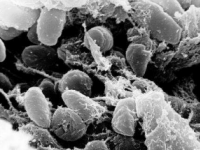 耶尔森菌感染引起细胞焦亡的新机制