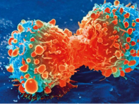 强大的卵巢癌新疗法可能会使更多患者受益