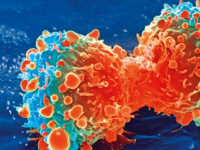 视网膜母细胞瘤资源研究人员创建更准确的研究模型